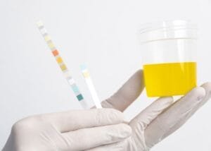 L'analyse d'urine en laboratoire pour le dépistage de drogue.