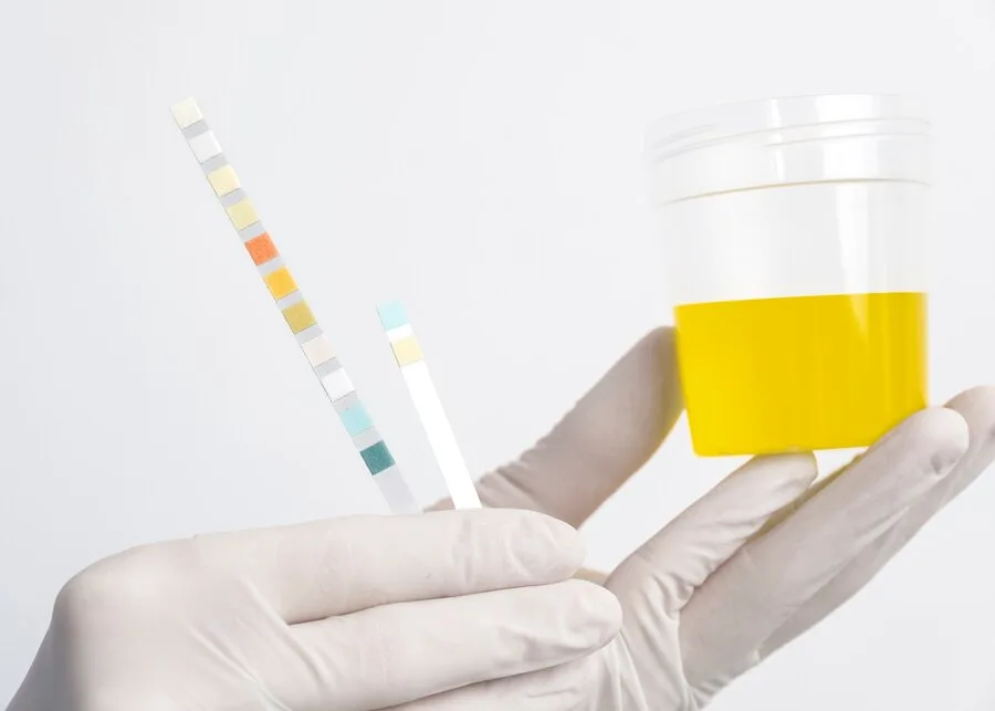 medecin-laboratoire-effectuant-examen-medical-urine_23-2149371988 L'analyse d'urine en laboratoire pour le dépistage de drogue.