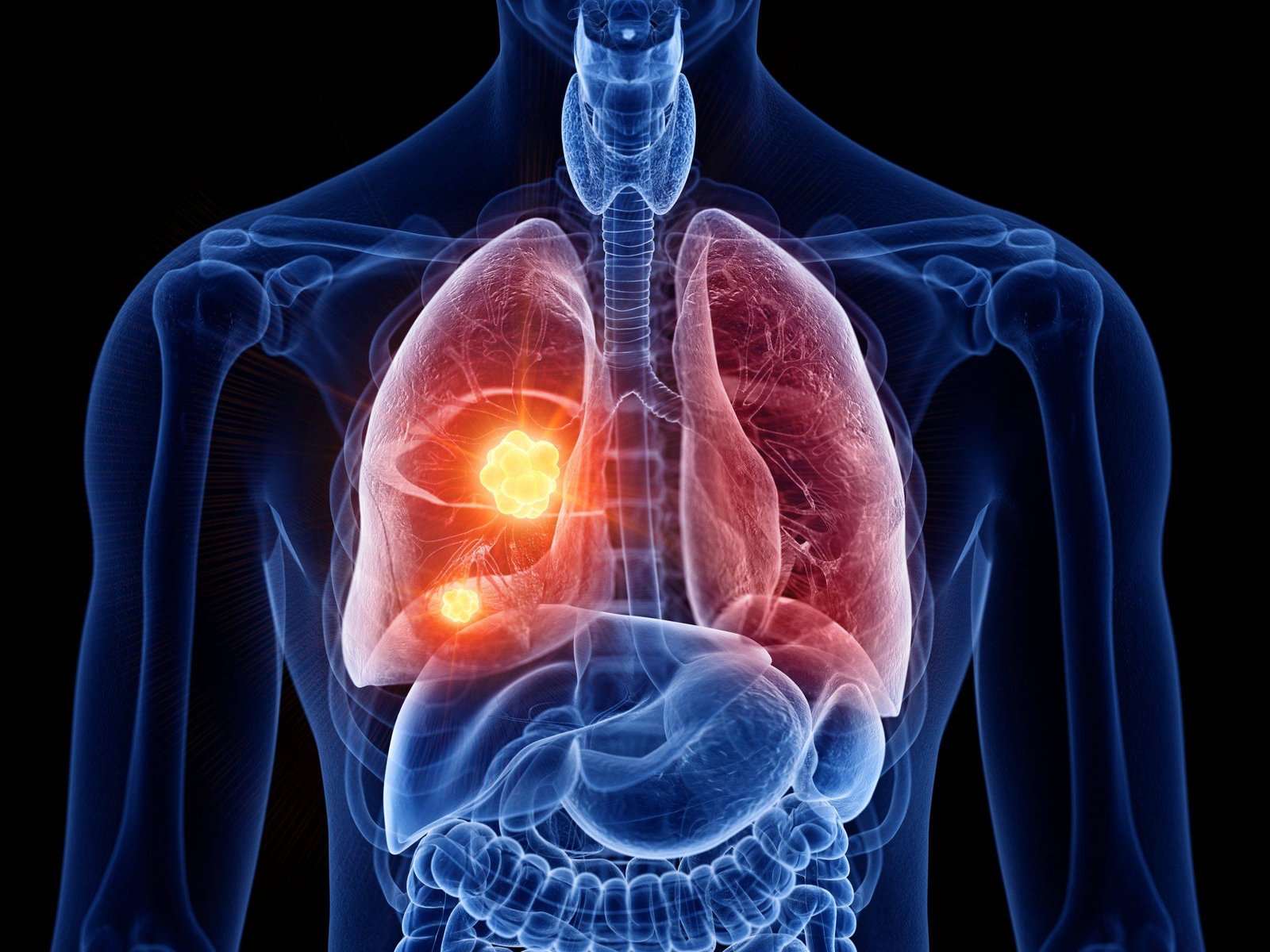 AdobeStock_282277137-1-scaled-1 L'inhalation de substance dangereuse et nocive crée des cellules cancéreuses dans les poumons.