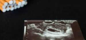 La cigarette peut causer des complications au bon déroulement d'une grossesse.