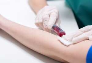 photos-prise-sang_acces-infirmieres-square-e1661170282908-1280×870 La prise de sang pour faire des analyse médicales.