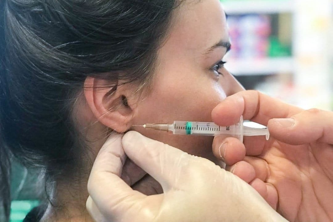 piqure La piqûre dans l'oreille contre le tabagisme.