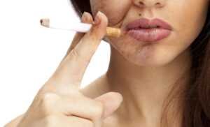 Le tabac est un facteur de vieillissement de la peau.