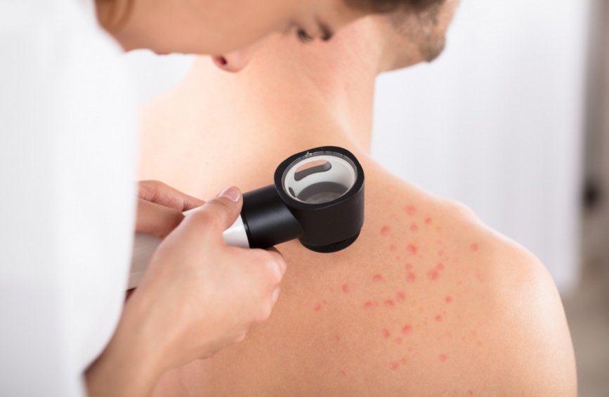 infections_cutanees_bacteriennes